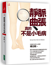 書籍:靜脈曲張,真的不是小毛病,作者:楊志勛