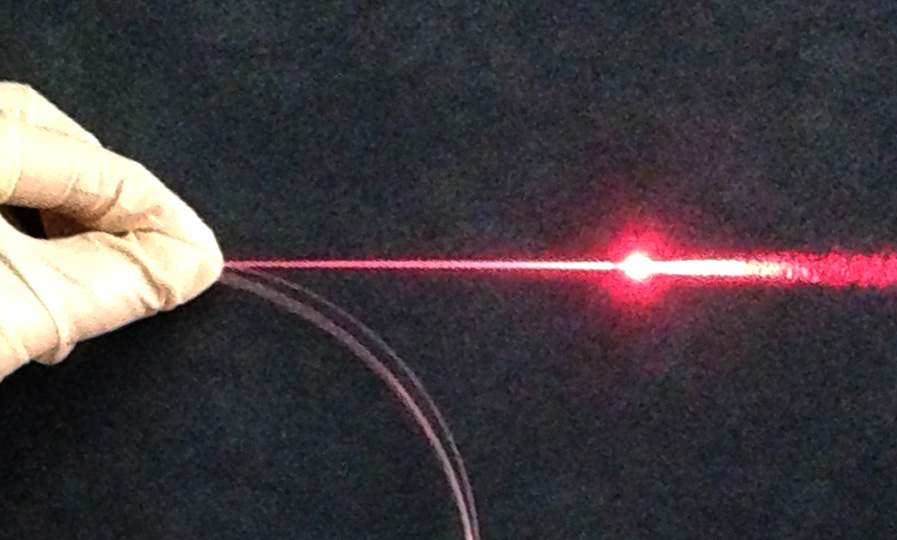 靜脈曲張-光纖雷射